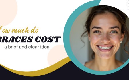How much do braces cost – a brief and clear idea!