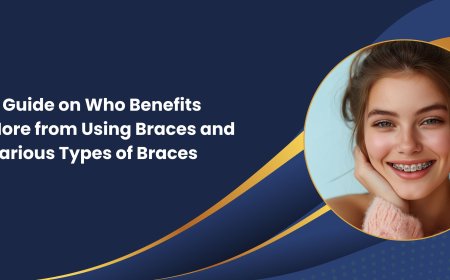 A Guide on Who Benefits More from Using Braces and Various Types of Braces