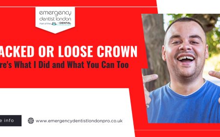 Cracked or Loose Crown? Here's What I Did and What You Can Too